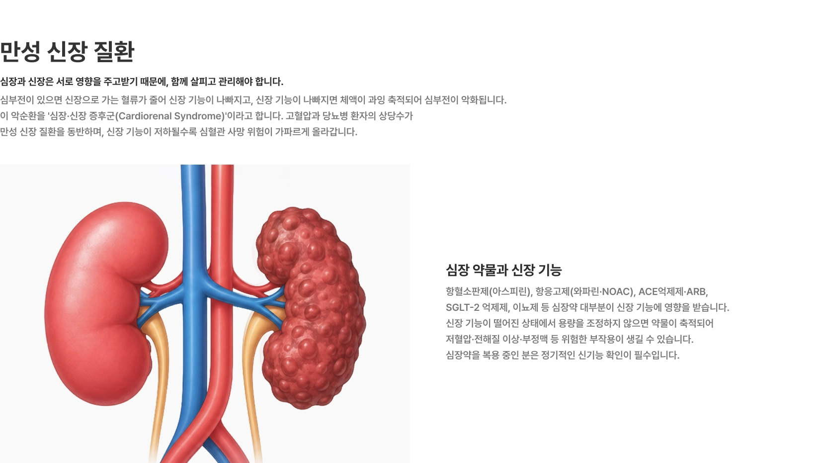 [만성 신장 질환] 심장과 신장은 서로 영향을 주고받기 때문에 함께 살피고 관리해야 합니다 심부전이 있으면 신장으로 가는 혈류가 줄어 신장 기능이 나빠집니다