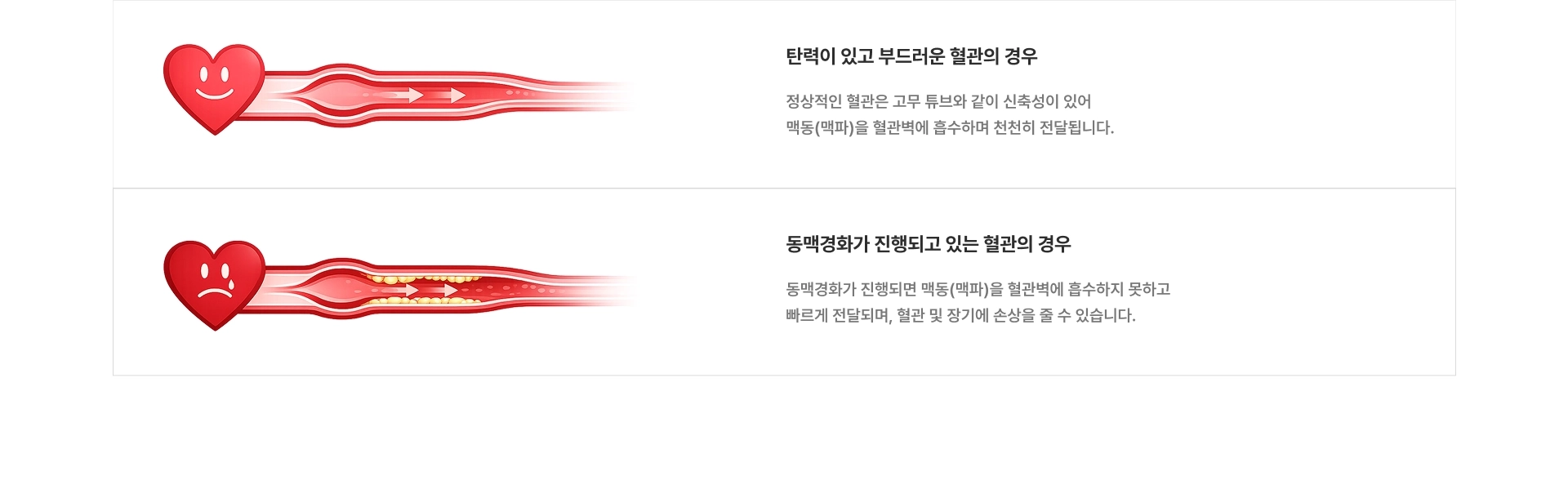 [탄력이 있고 부드러운 혈관의 경우] 정상적인 혈관은 고무 튜브와 같이 신축성이 있어 맥동(맥파)을 혈관벽에 흡수하며 천천히 전달됩니다 [동맥경화가 진행되고 있는 혈관의 경우] 동맥경화가 진행되면 맥동(맥파)을 혈관벽에 흡수하지 못하고 빠르게 전달되며, 혈관 및 장기에 손상을 줄 수 있습니다
