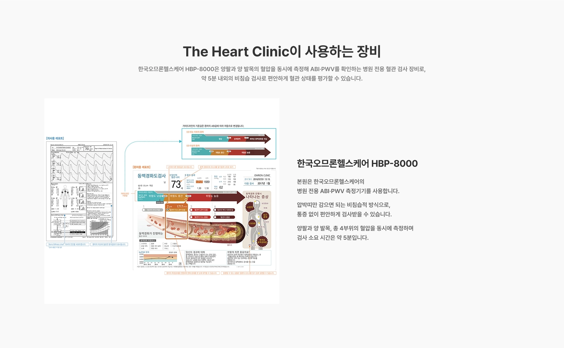 [The Heart Clinic이 사용하는 장비] 한국오므론헬스케어 HBP-8000은 양팔과 양 발목의 혈압을 동시에 측정해 ABI·PWV를 확인하는 병원 전용 혈관 검사 장비로, 약 5분 내외의 비침습 검사로 편안하게 혈관 상태를 평가할 수 있습니다