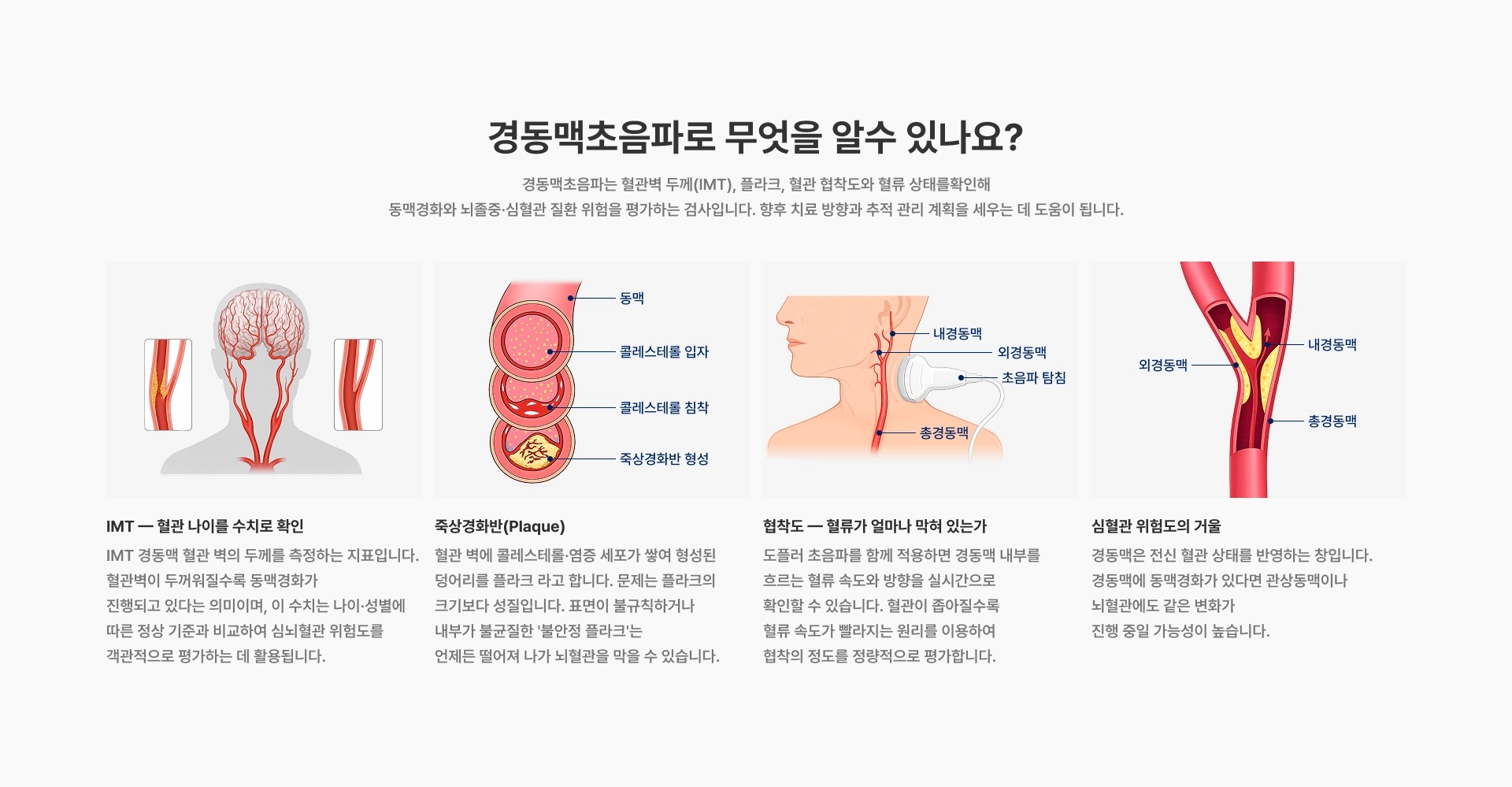 [경동맥초음파로 무엇을 알수 있나요?] IMT — 혈관 나이를 수치로 확인 죽상경화반(Plaque) 협착도 — 혈류가 얼마나 막혀 있는가 심혈관 위험도의 거울 내경동맥 외경동맥 총경동맥 초음파 탐침
