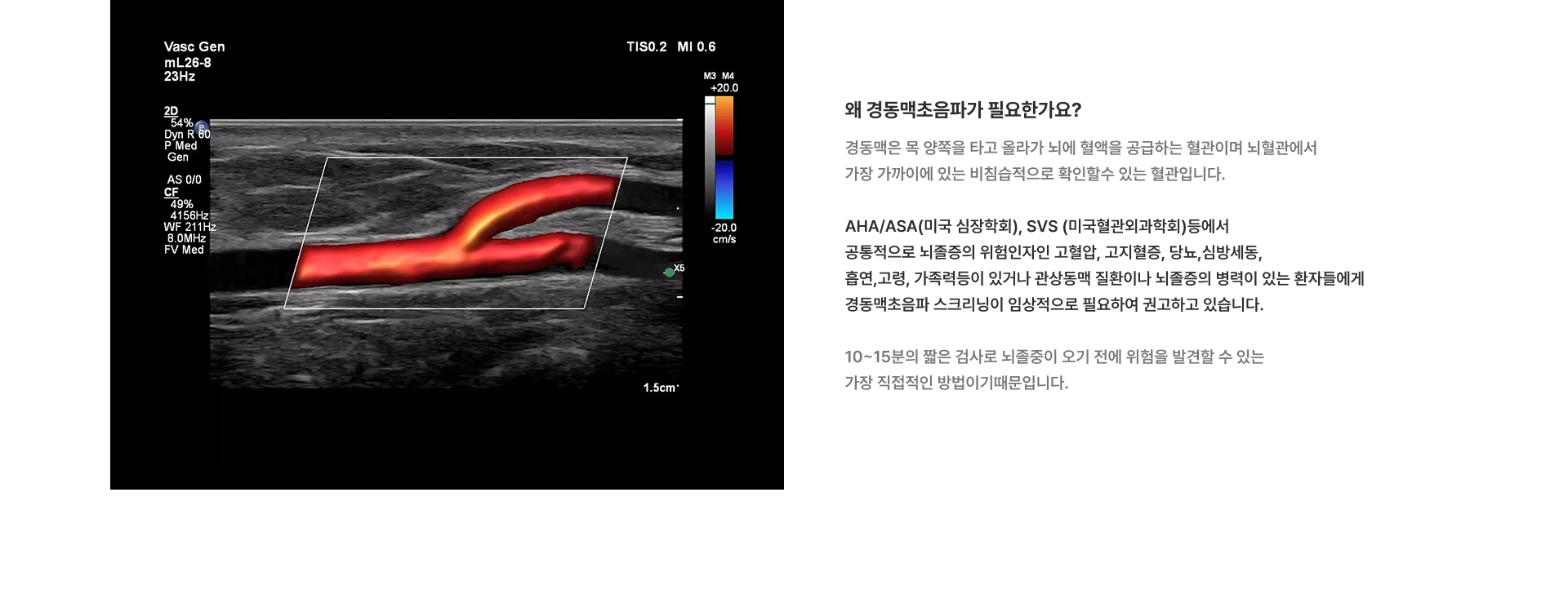 [왜 경동맥초음파가 필요한가요?] 경동맥은 목 양쪽을 타고 올라가 뇌에 혈액을 공급하는 혈관이며 뇌혈관에서 가장 가까이에 있는 비침습적으로 확인할수 있는 혈관입니다 10~15분의 짧은 검사로 뇌졸중이 오기 전에 위험을 발견할 수 있는 가장 직접적인 방법이기때문입니다
