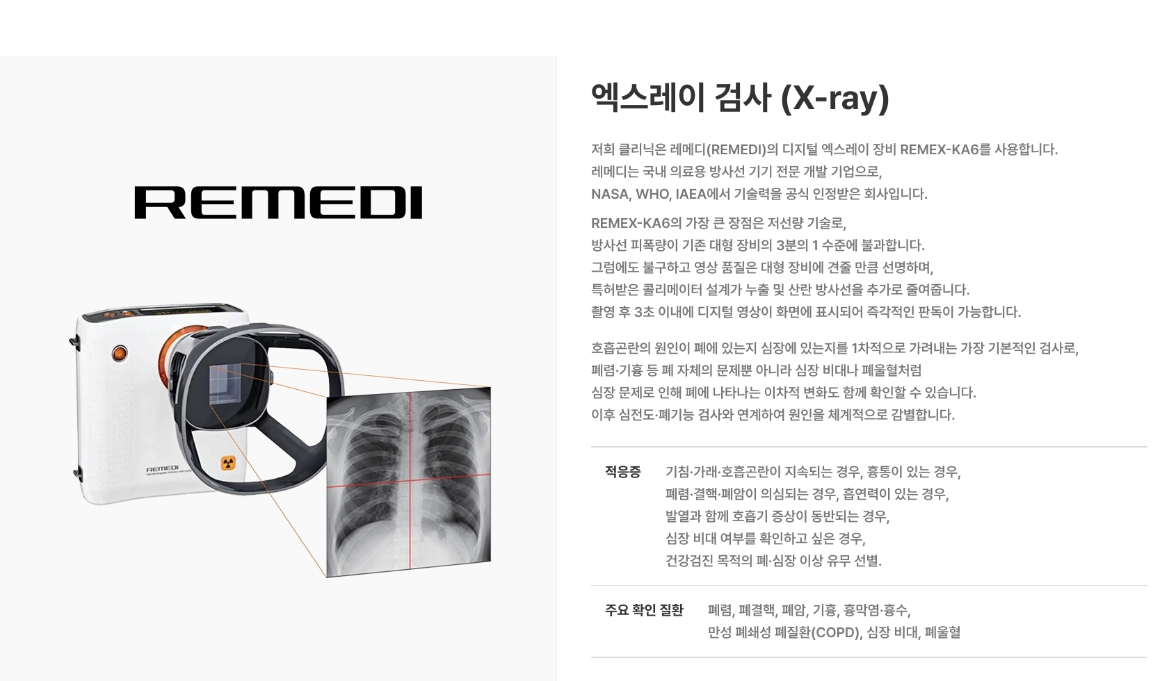 [엑스레이 검사 (X-ray)] 레메디(REMEDI)의 디지털 엑스레이 장비 REMEX-KA6를 사용합니다 저선량 기술로 방사선 피폭량이 기존 대형 장비의 3분의 1 수준 주요 확인 질환 폐렴, 폐결핵, 폐암, 기흉, 흉막염·흉수, 만성 폐쇄성 폐질환(COPD), 심장 비대, 폐울혈