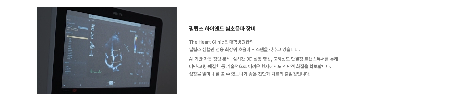 [필립스 하이엔드 심초음파 장비] The Heart Clinic은 대학병원급의 필립스 심혈관 전용 최상위 초음파 시스템을 갖추고 있습니다 AI 기반 자동 정량 분석, 실시간 3D 심장 영상, 고해상도 단결정 트랜스듀서